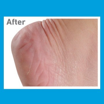 O'Keeffe's Healthy Feet