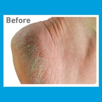 O'Keeffe's Healthy Feet