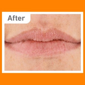 O'Keeffe's Lip Repair