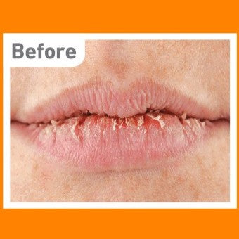 O'Keeffe's Lip Repair